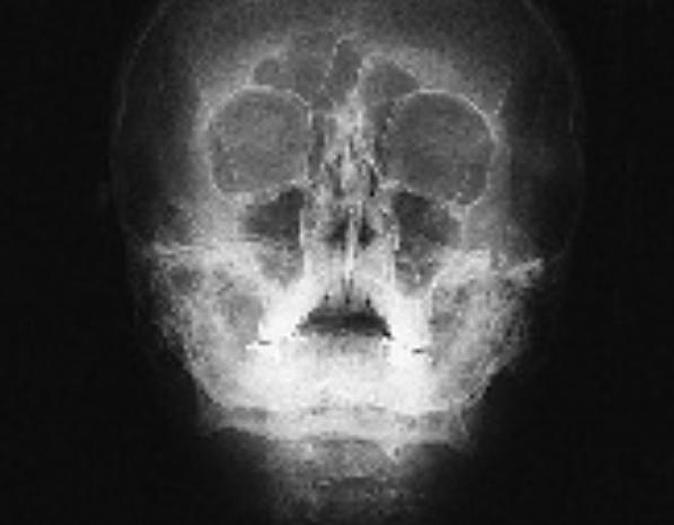 Usado 2001 General Electric (GE) Proteus Xr/a