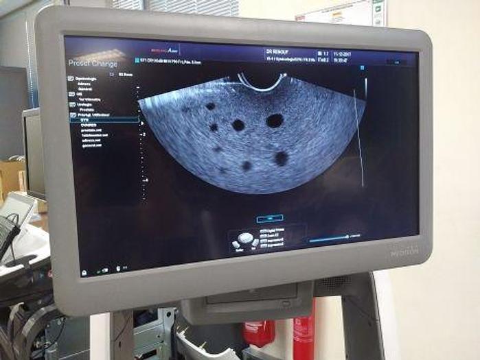 Used SAMSUNG MEDISON Accuvix A30 OB / GYN - Vascular Ultrasound