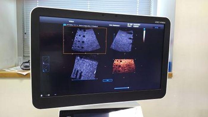 Refurbished SAMSUNG WS80A OB / GYN - Vascular Ultrasound