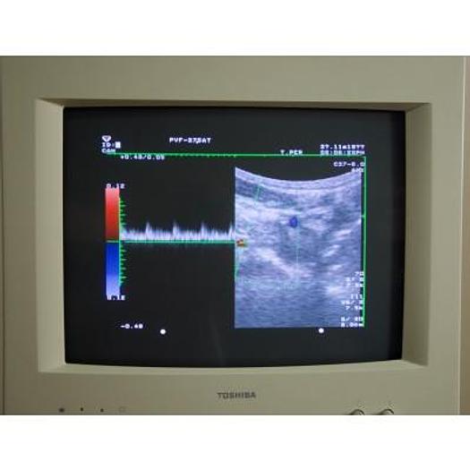 Usato ECHOGRAPHE COULEUR DOPPLER TOSHIBA ECOCEE SSA 340