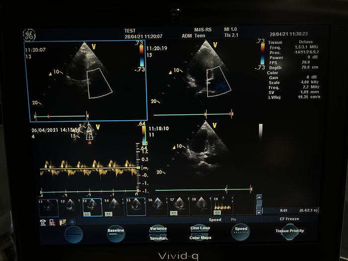 Gebraucht GE Vivid q Ultraschallgerät auf Vivid i Trolley mit 2 Sonden und EKG Kabel