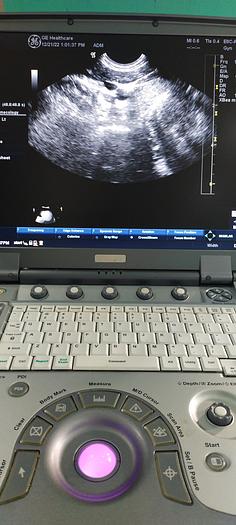 Gebraucht GE E8C-RS Transvaginal Ultraschallsonde