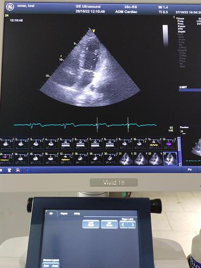 Gebraucht GE Vivid T8