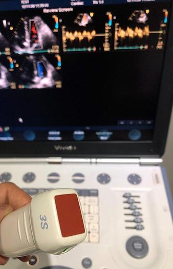 Used GE Vivid i Ultraschallgerät mit Kardio-Sonde Software Version 2.1.16 auf GE Vivid i Trolley