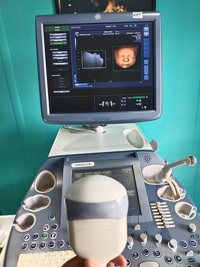 Gebraucht GE Voluson E8 Flachbildschirm Ultraschallgerät inkl. IC5-9-D Sonde und Sony UP-D897 Drucker Ultrasound