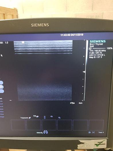 Used SIEMENS S2000 OB / GYN - Vascular Ultrasound