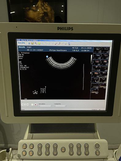 Gebraucht Philips HD 11 XE Ultraschallgerät mit 5x Sonden
