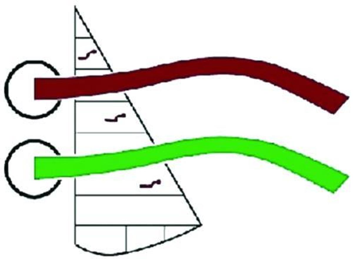 Air-Flow Tels (14/pk)