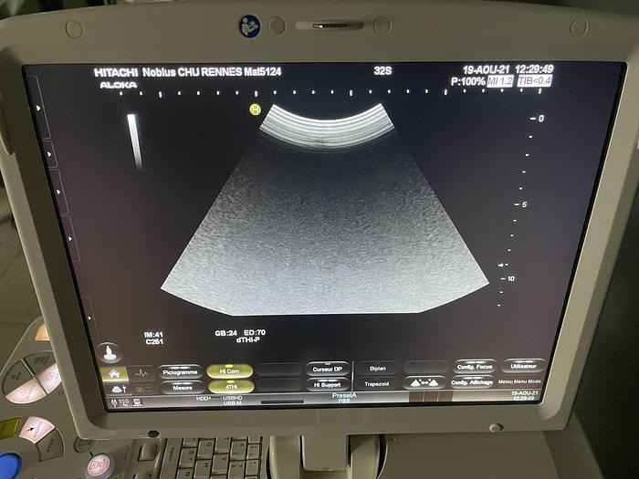 Gebraucht Hitachi/Aloka Noblus Ultraschallgerät auf Cart mit 2 Ultraschallsonden