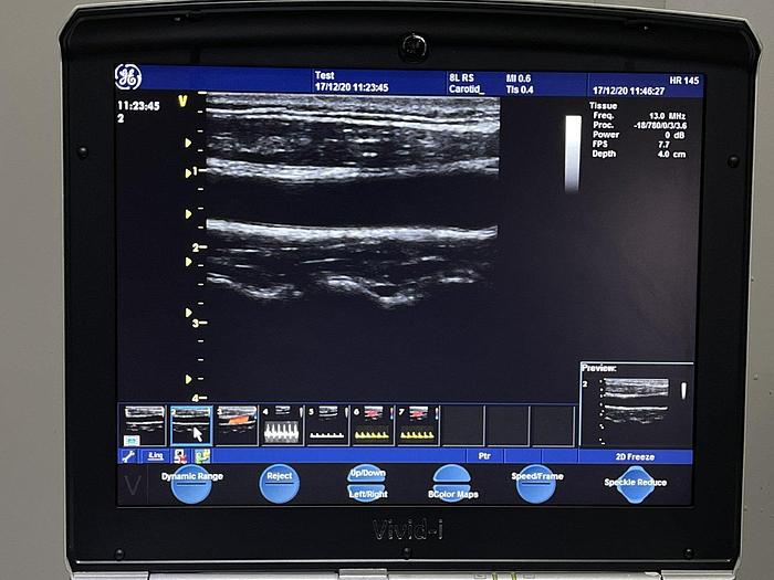 Used GE Vivid i Ultraschallgerät mit 2x Sonden Software Version 2.1.16 auf GE Vivid i Trolley