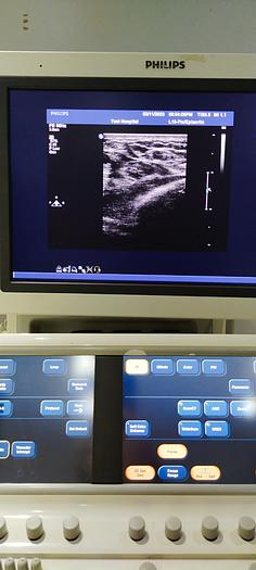Gebraucht Philips L15-7io Linear Ultraschallsonde