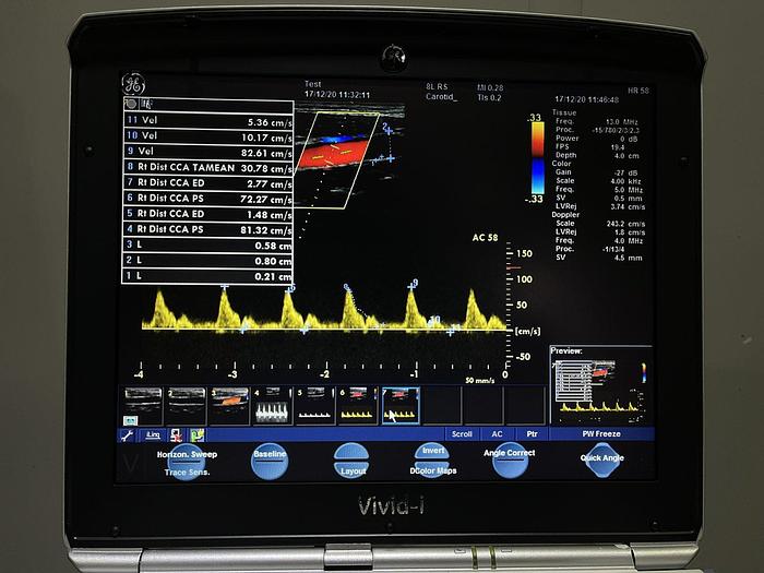 Used GE Vivid i Ultraschallgerät mit 2x Sonden Software Version 2.1.16 auf GE Vivid i Trolley