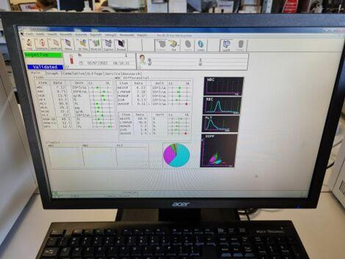 Used For Sale SYSMEX XS-1000i Hematology Analyzer
