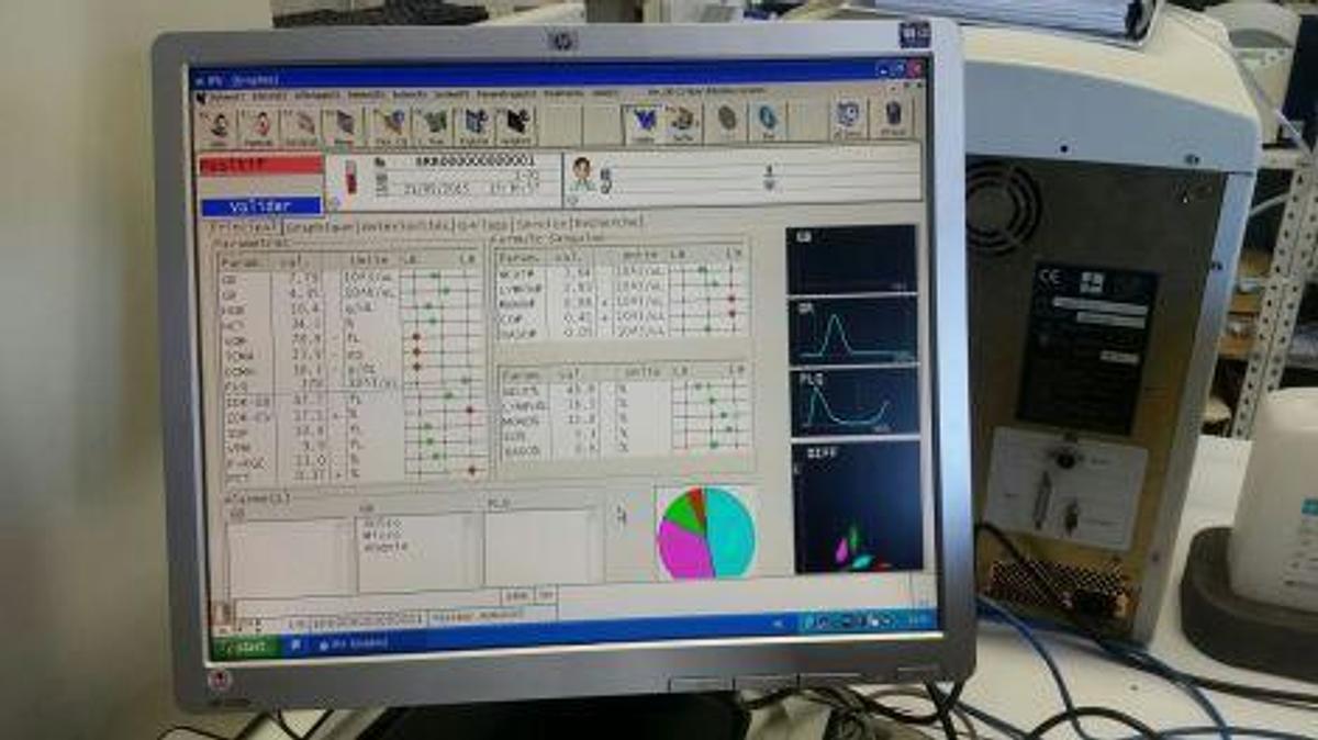 Used SYSMEX XS-1000i Hematology Analyzer