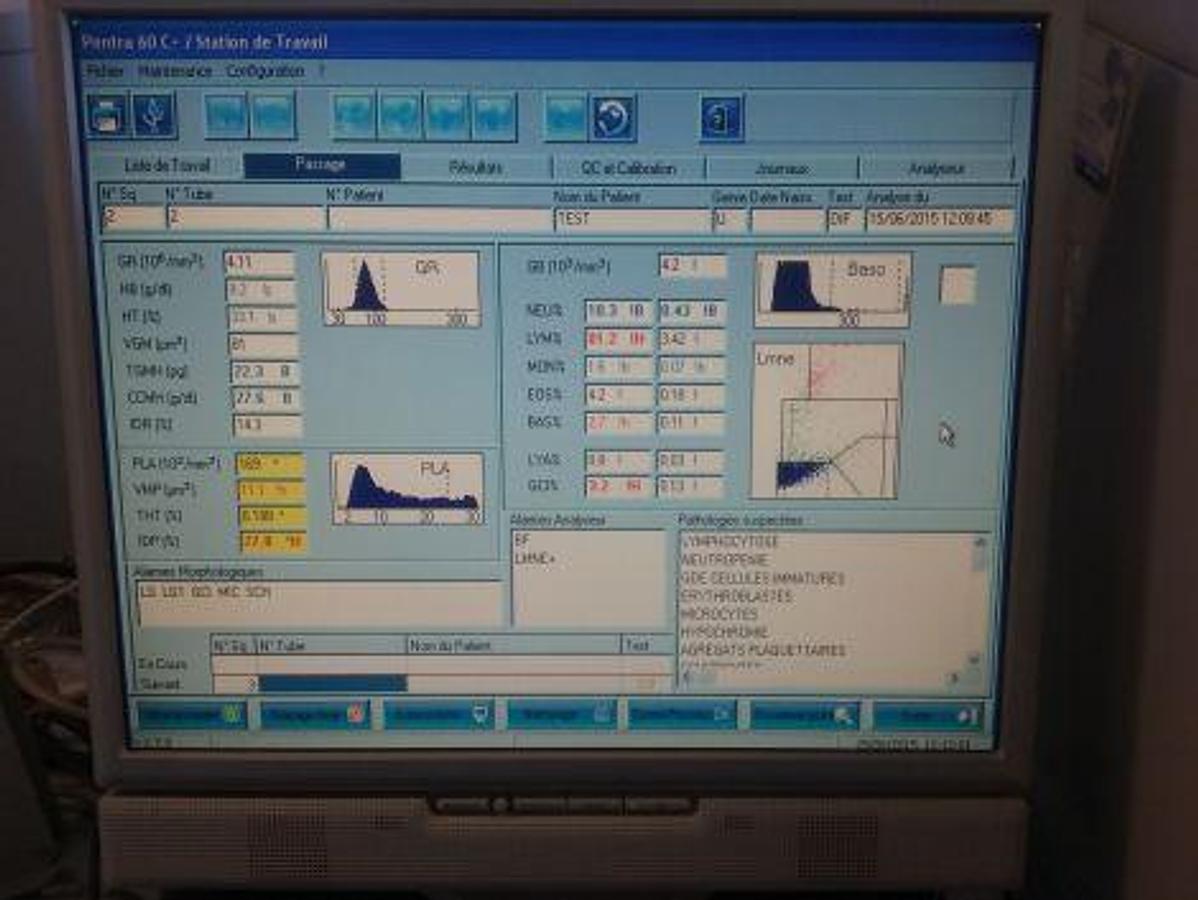 Used HORIBA ABX Pentra 60 C+ Hematology Analyzer