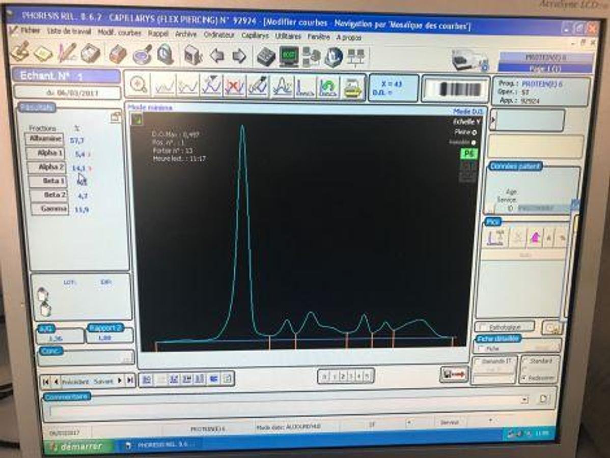Usado SEBIA CAPILLARYS 2 FLEX PIERCI Electrophoresis Unit