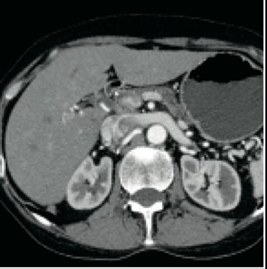 Reformado 2005 General Electric (GE) LightSpeed VCT