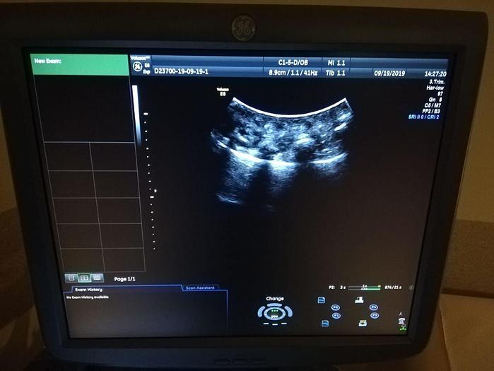 Used For Sale GE C15-d Ultrasound Transducer