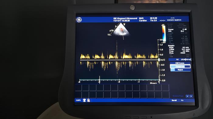 Gebraucht GE Vivid 7 Dimension