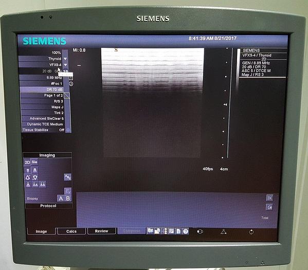 Gebraucht Siemens Acuson Antares Premium Edition 10032746 Ultraschallgerät Flachbildmonitor 5 Sonden Drucker