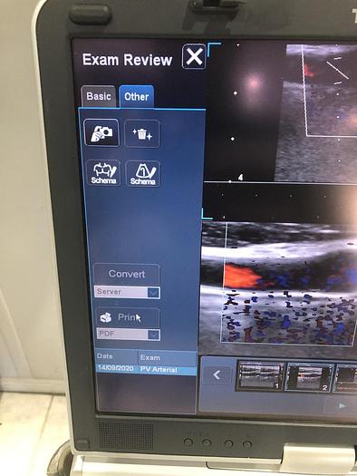 Gebraucht Toshiba Viamo Ultraschallsystem mit 1x Sonde auf Trolley