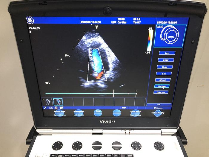 Used GE Vivid i Ultraschallsystem mit Kardio Sonde Software Version 2.1.16 auf GE Vivid i Trolley