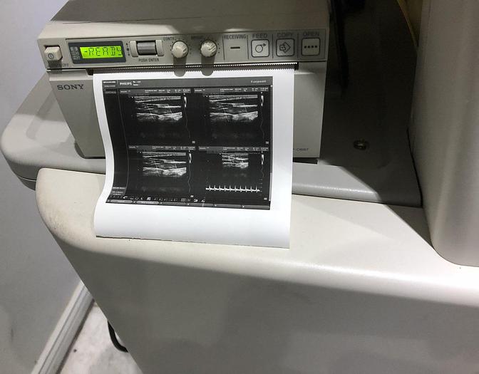 Used Philips HD9 Ultraschallgerät mit 3 Sonden 3D/4D-option