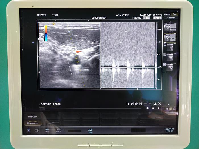 Gebraucht Hitachi Hi Vision Preirus Ultraschallgerät inkl. 3 Sonden, 