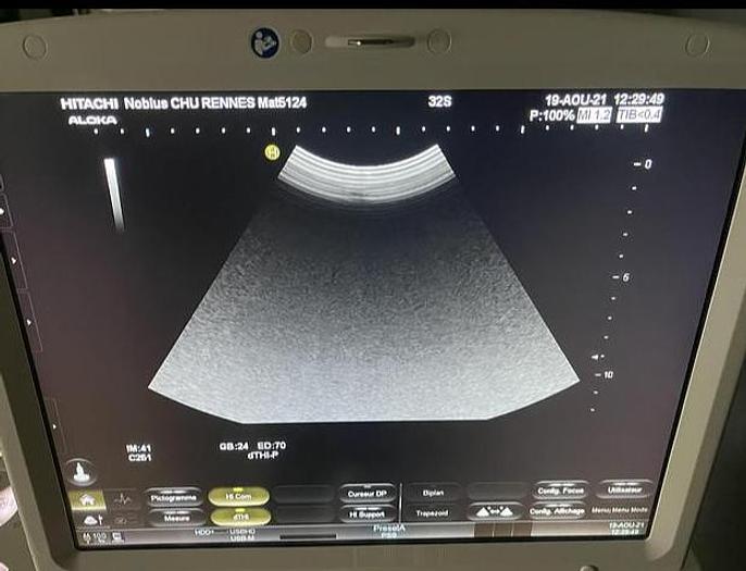 Gebraucht GE Ultraschall sonde Hitachi C251