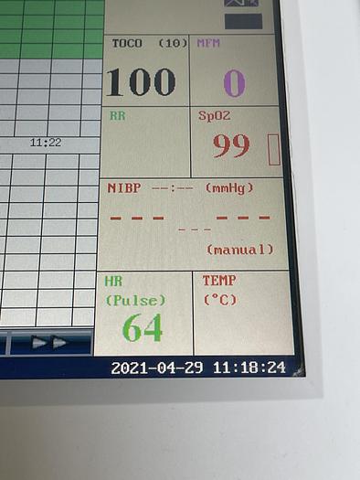 Gebraucht EDAN F9 SN 0002 