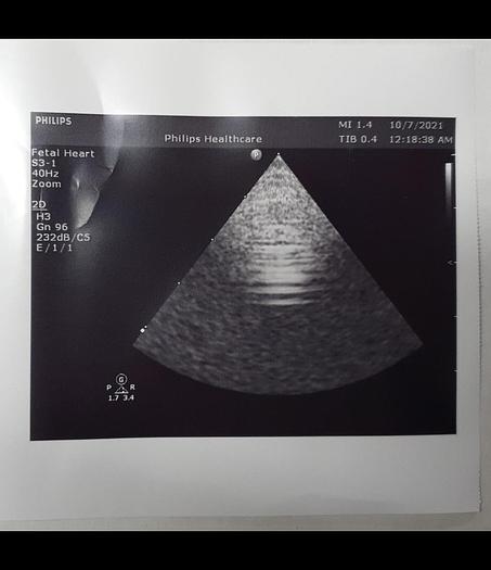 Gebraucht Philips S3-1 Sektor Ultraschallsonde