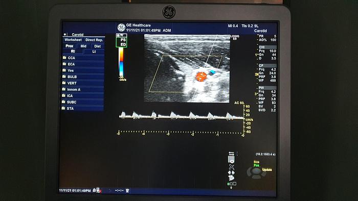 Gebraucht GE Logiq S8