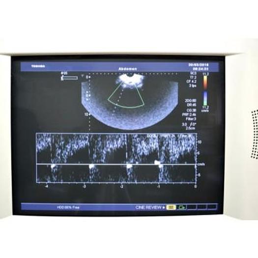 Used TOSHIBA APLIO 80 XARIO AVEC 4 SONDES