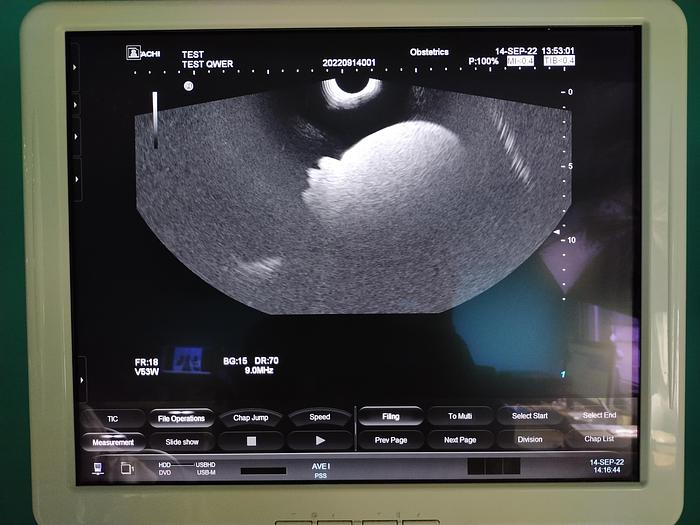 Gebraucht Hitachi Hi Vision Preirus Ultraschallgerät inkl. 3 Sonden, 