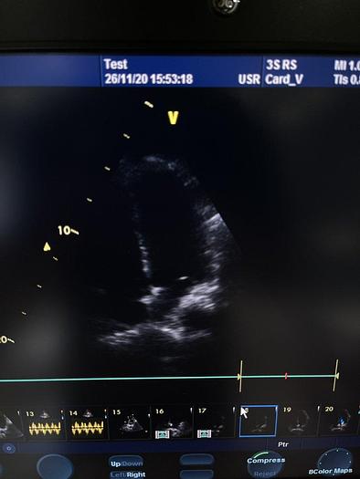 Used GE Ultraschallsonde Kardio / Sektor 3S-RS