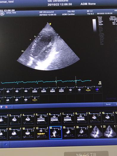 Gebraucht GE Vivid T8