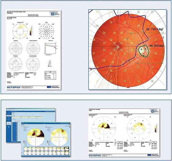 Refurbished Haag Streit Octopus 300 Visual Field Perimeter
