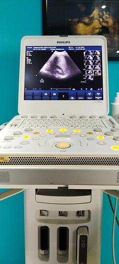 Gebraucht Philips CX50 tragbare Ultraschallgerät auf Philips CX Wagen inkl. Netzteil