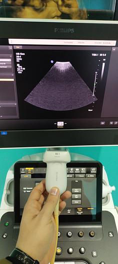 Gebraucht Philips X6-1 X-matrix 3D/4D