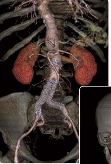 Used 2018 General Electric (GE) Optima CT540