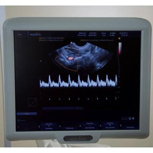 D'occasion ECHOGRAPHE  "RADIO+CARDIO"  MEDISON SONOACE X8 COULEUR DOPPLER 4 SONDES