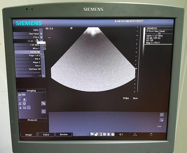 Gebraucht Siemens Acuson Antares Premium Edition 10032746 Ultraschallgerät Flachbildmonitor 5 Sonden Drucker