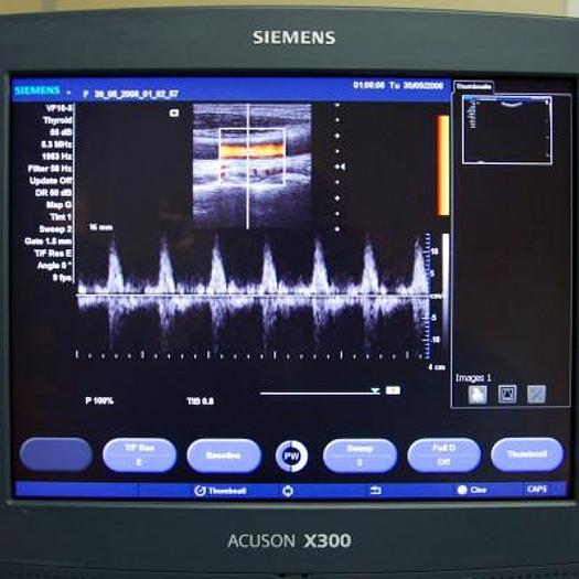 D'occasion ECHOGRAPHE SIEMENS ACUSON X300 AVEC 4 SONDES ET ECRAN PLAT