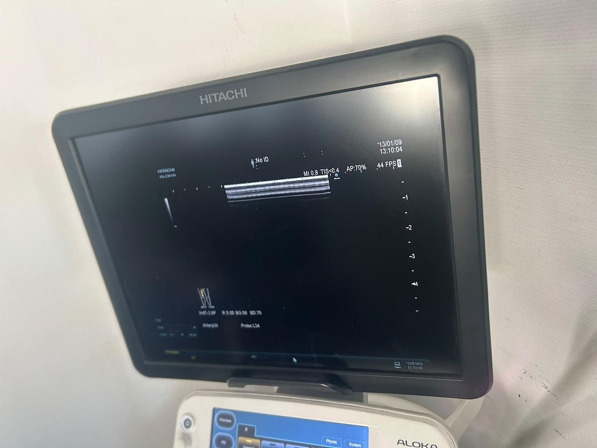Used Hitachi Aloka Arietta V70 | 4 Probes | Colour Doppler | Tested