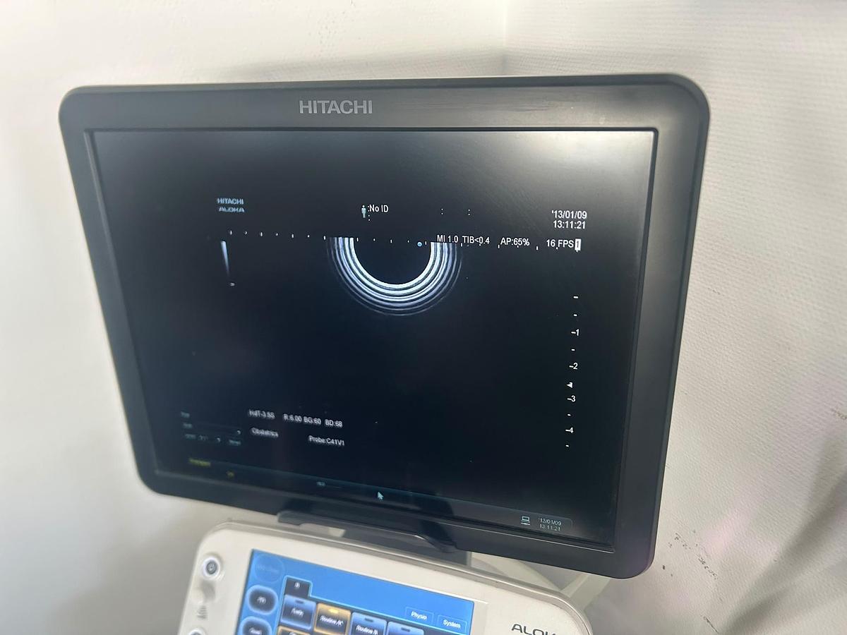 Used Hitachi Aloka Arietta V70 | 4 Probes | Colour Doppler | Tested