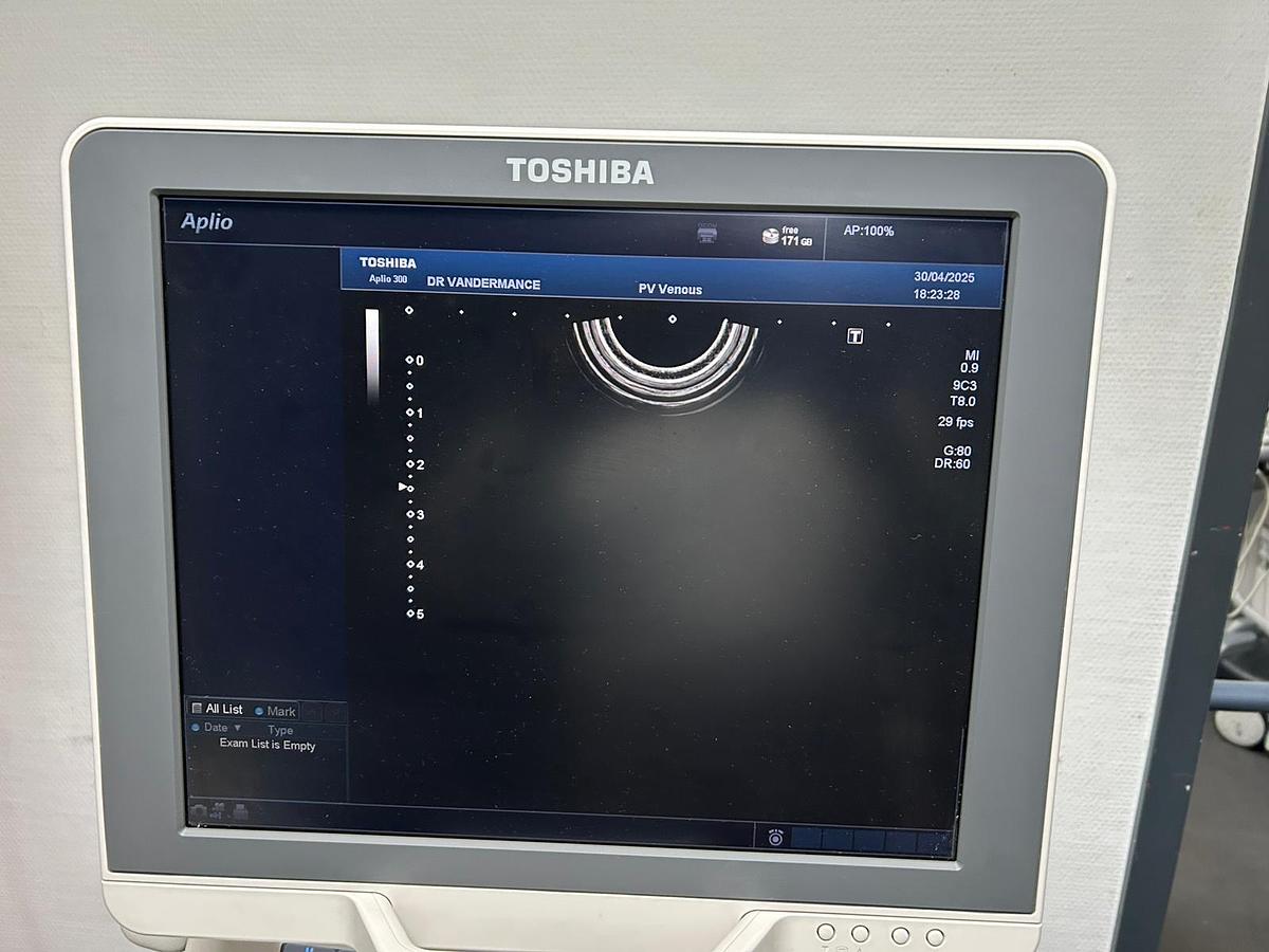 Used TOSHIBA Aplio 300 (TUS-A300)