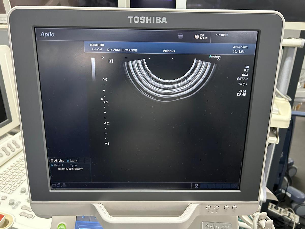 Used TOSHIBA Aplio 300 (TUS-A300)