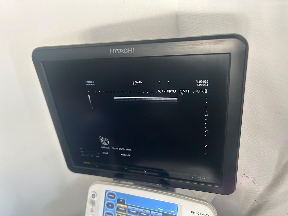 Used Hitachi Aloka Arietta V70 | 4 Probes | Colour Doppler | Tested