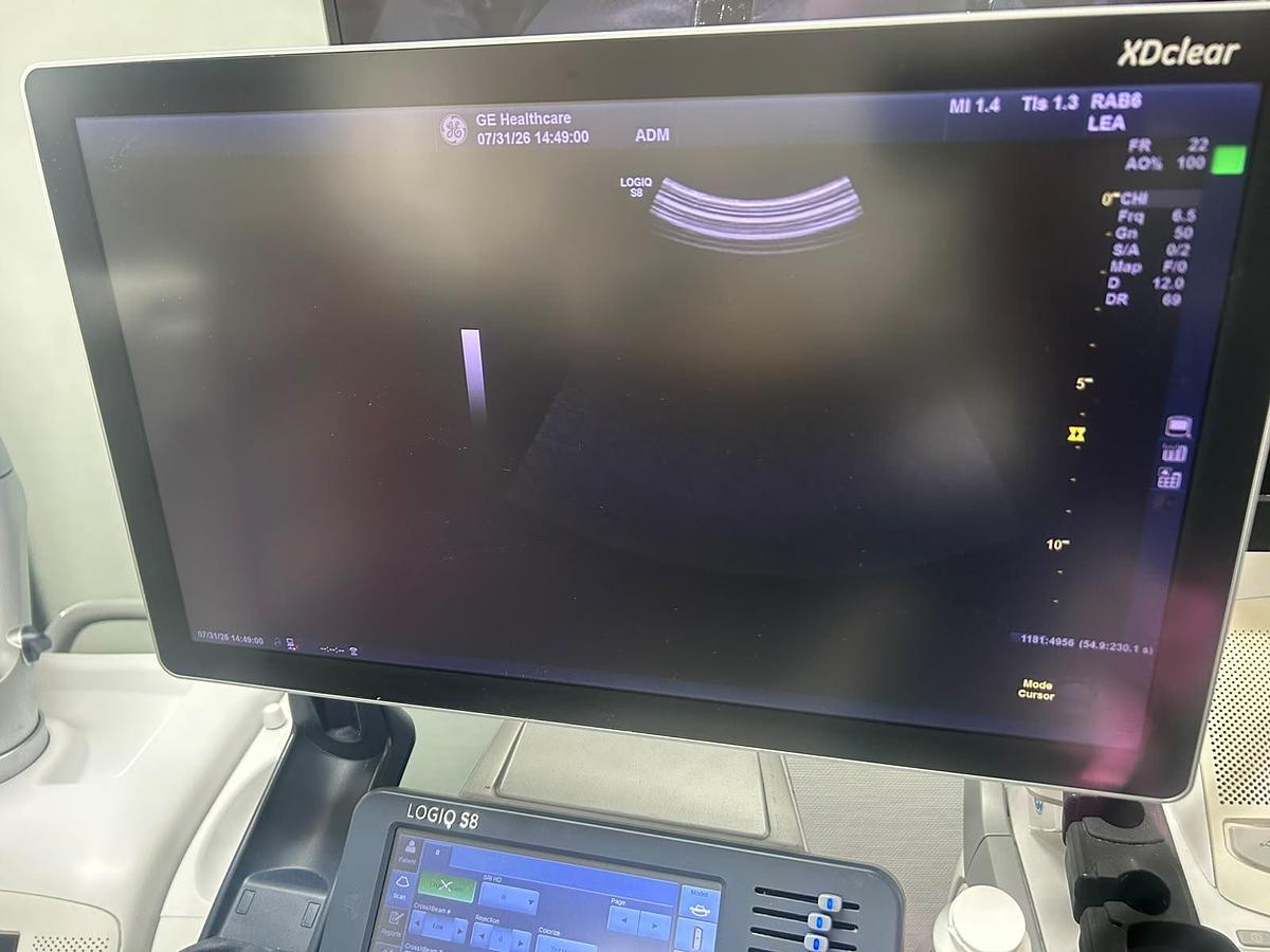 Used GE RAB6-D 4D Volume Ultrasound Probe | Excellent Image | Tested |
