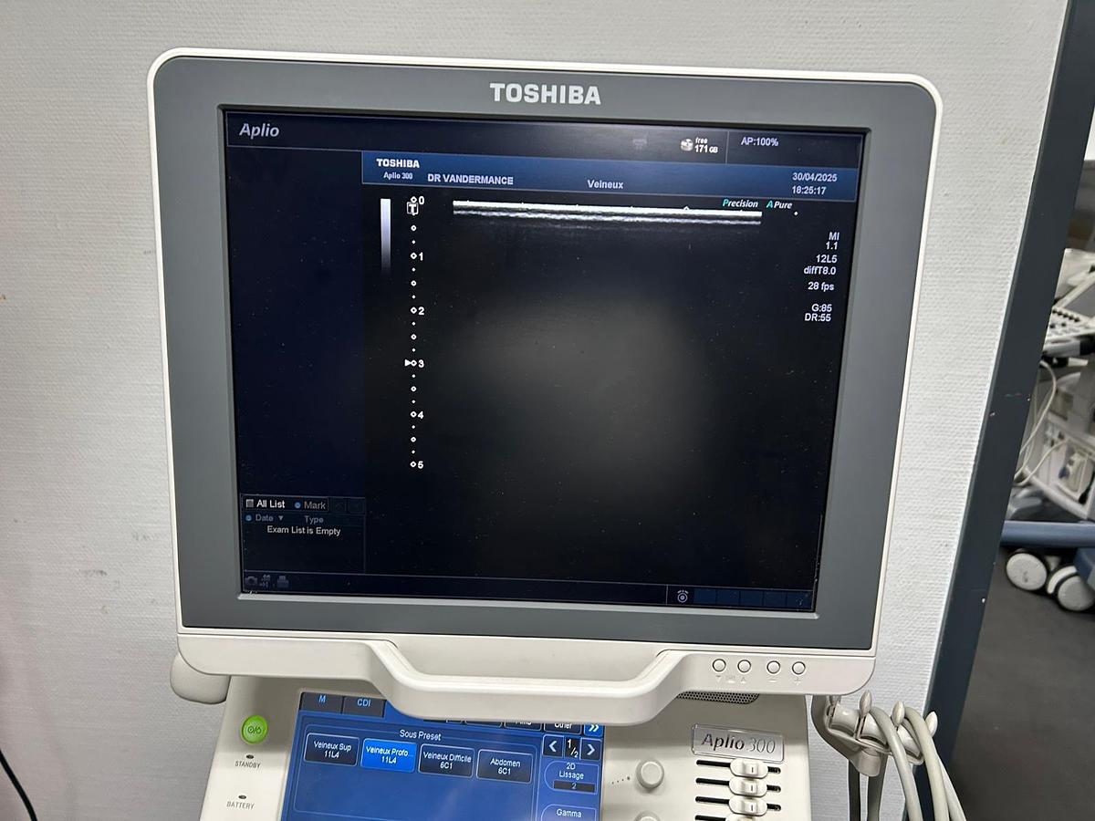 Used TOSHIBA Aplio 300 (TUS-A300)